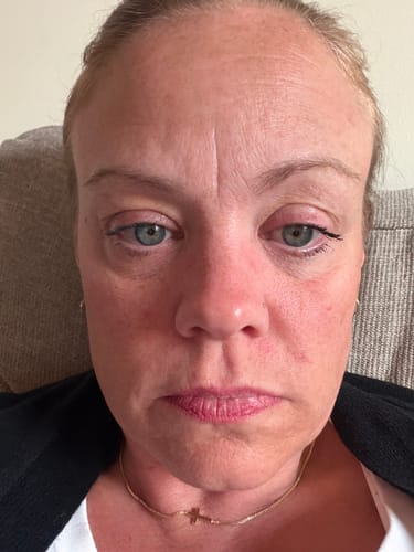 Close-up of reviewer's face on day one of using the Deep Collagen Cream.