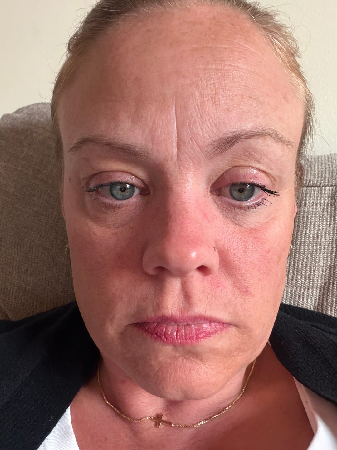 Customer photo review of 1 Month Supply - Deep Collagen Cream