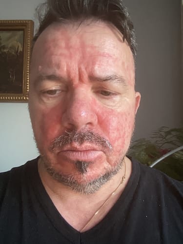 Customer photo review of Seb Natural Soothing Balm