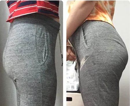 Customer photo review of NextGen Ultra Glute Stimulator