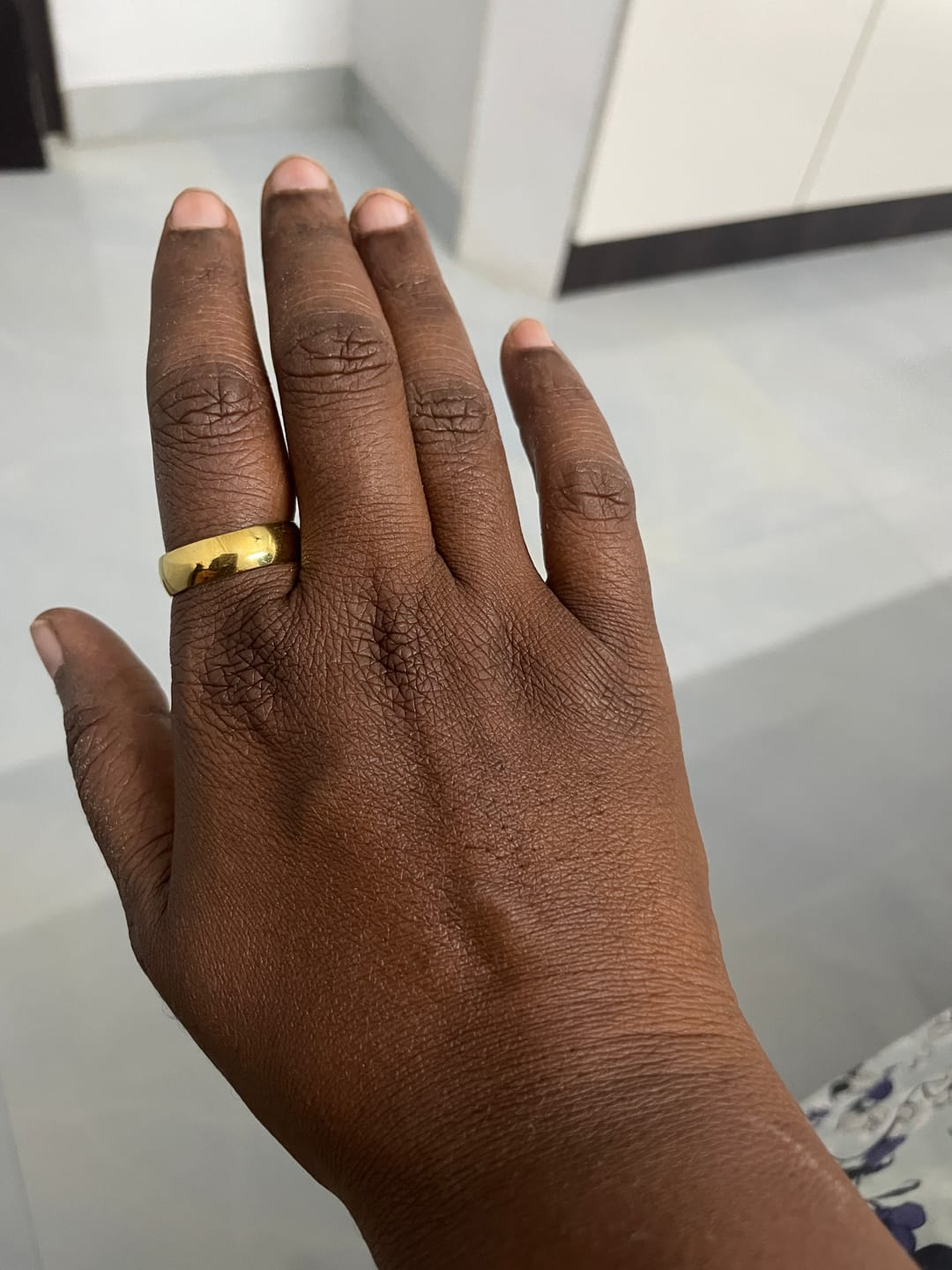 Customer photo review of Bold Gleam Classic Dome Ring
