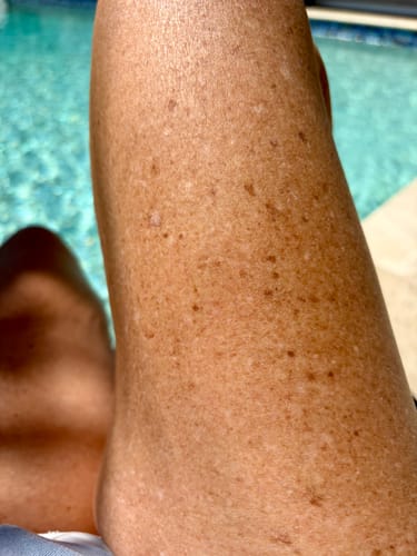Customer photo review of Besque® Magic Body Oil - Unscented