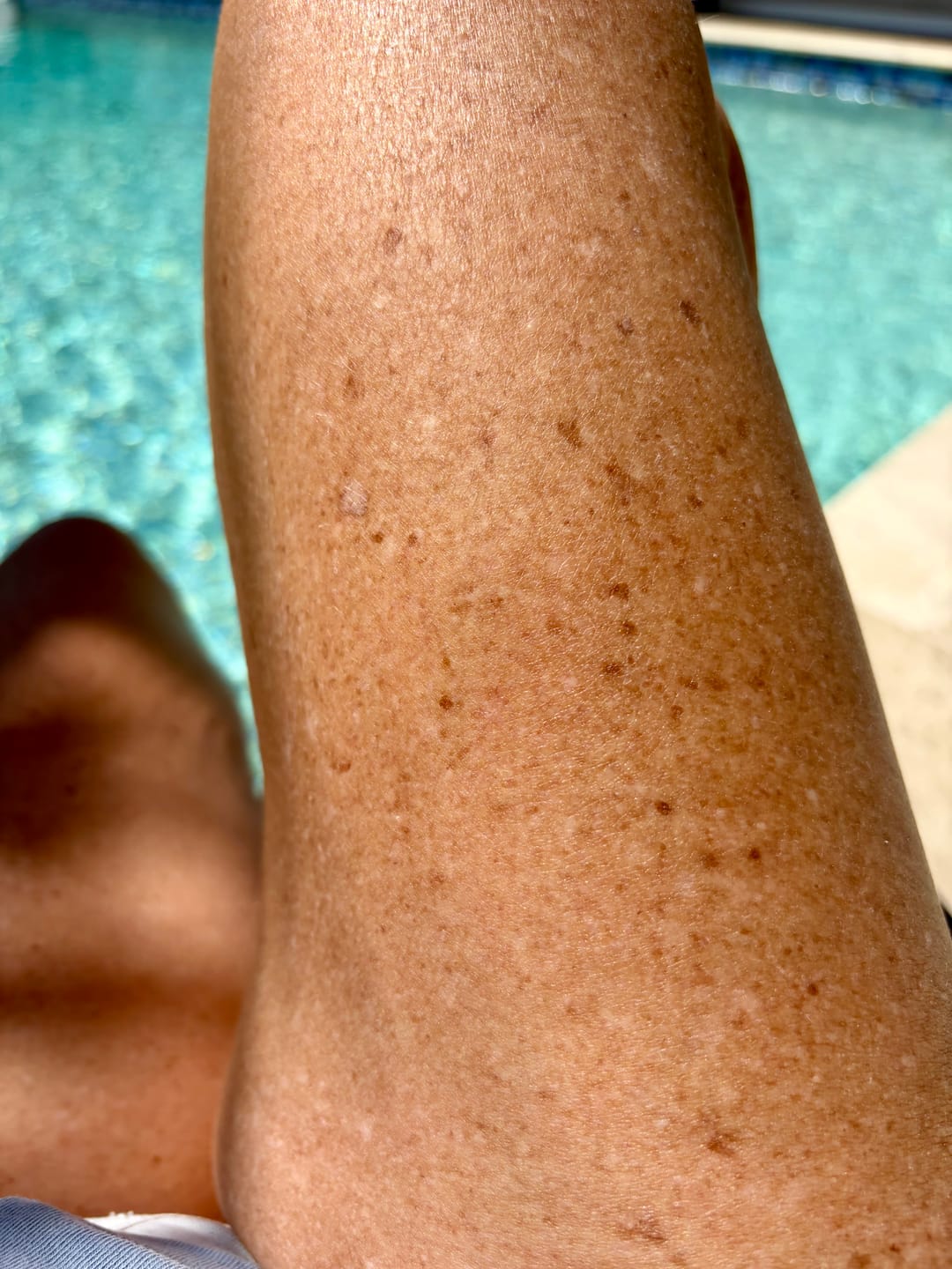 Customer photo review of Besque® Magic Body Oil - Unscented