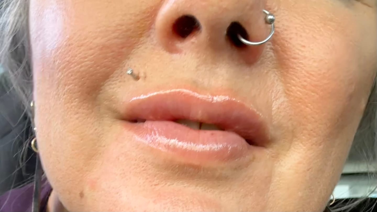 Customer photo review of Extreme Lip Plumper