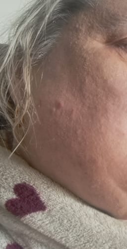Customer photo review of Organic Tallow Balm