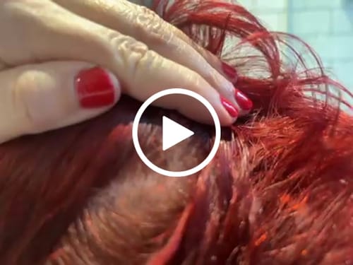 Customer video review of Seb Natural Calming Serum