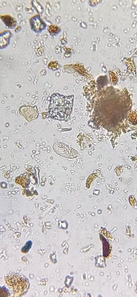 Customer photo review of Microbiology Testing