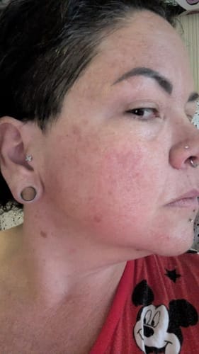 Customer photo review of Organic Tallow Balm
