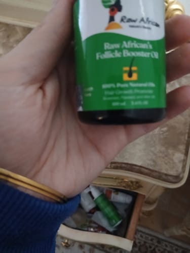 Customer photo review of Hair Follicle Booster Oil