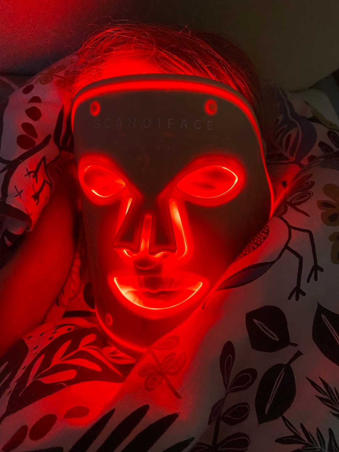 Customer photo review of Skinboosting LED mask
