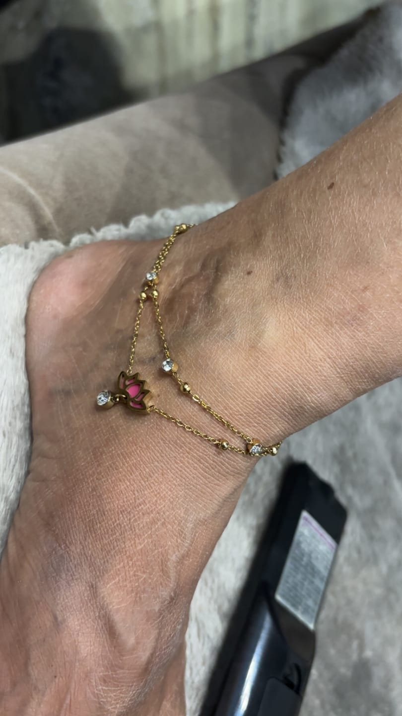 Customer photo review of Water Lily Anklet