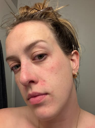Customer photo review of Blue Tansy Serum