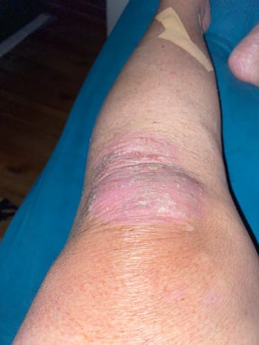 Customer photo review of Organic Tallow Balm