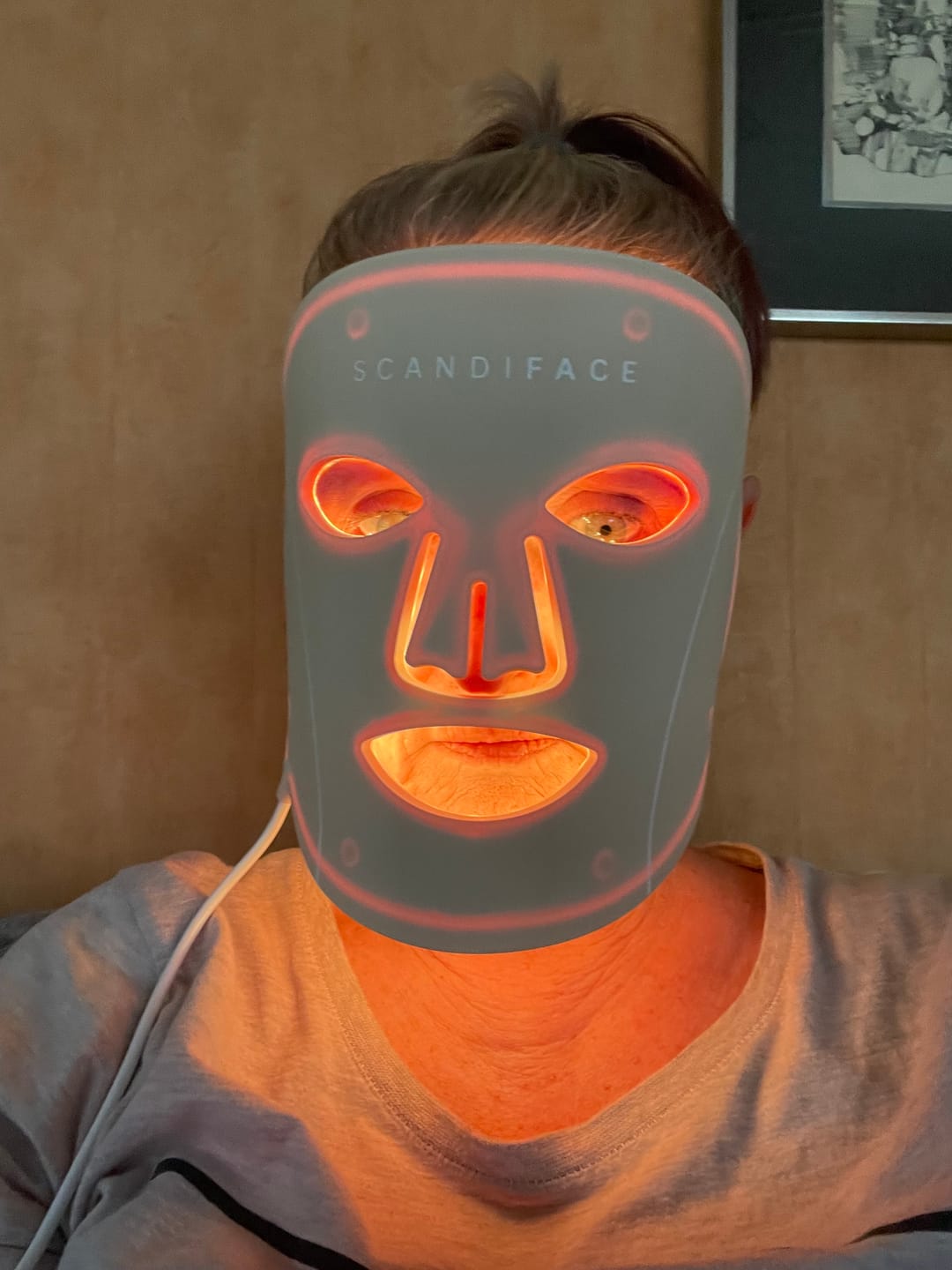 Customer photo review of Skinboosting LED mask