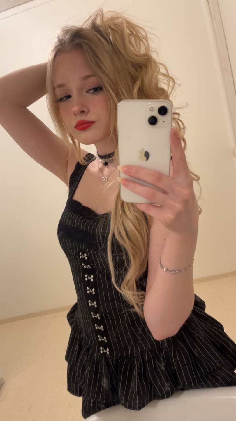 Customer photo review of Grunge Doll Stripes Flared Romper Dress 3.0 (split two-piece set)