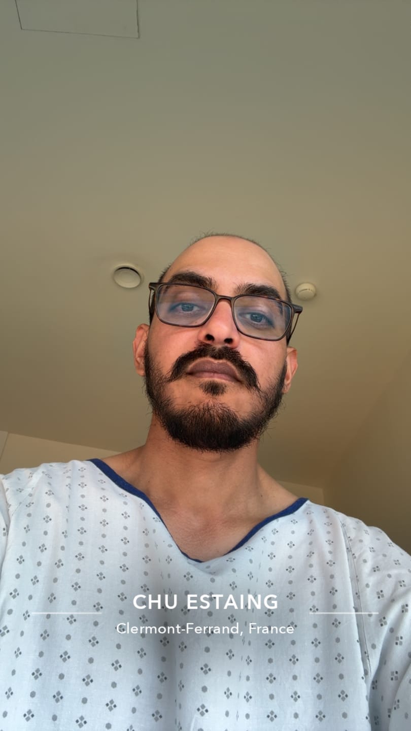 Customer photo review of Activator Serum | Booster Croissance de barbe