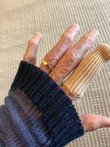 Customer photo review of Silipos Ribbed Digital Caps – Gel Toe Protection Caps