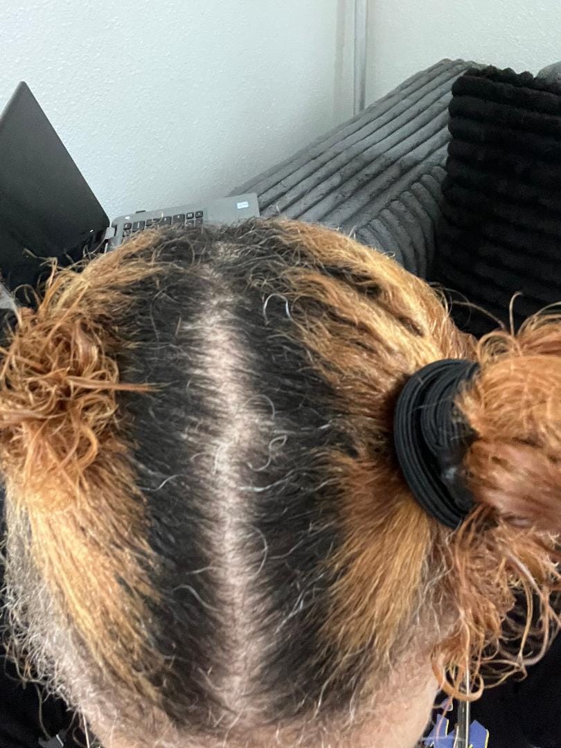 Customer photo review of Herbal Follicle Stimulator Oil - Scalp & Hair Strengthening
