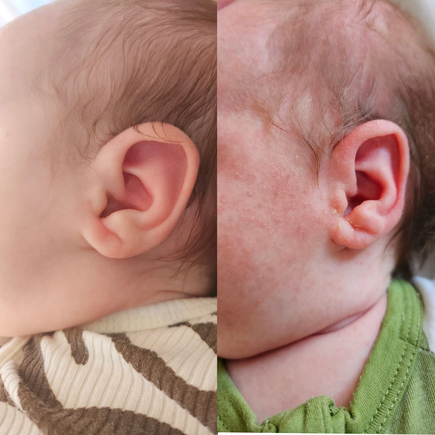 Customer photo review of Manuka Moisturising Baby Butter