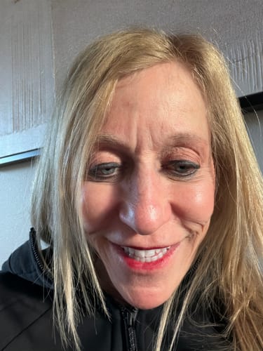 A close-up of a reviewer smiling, showing her facial skin for The Micro Infusion System.