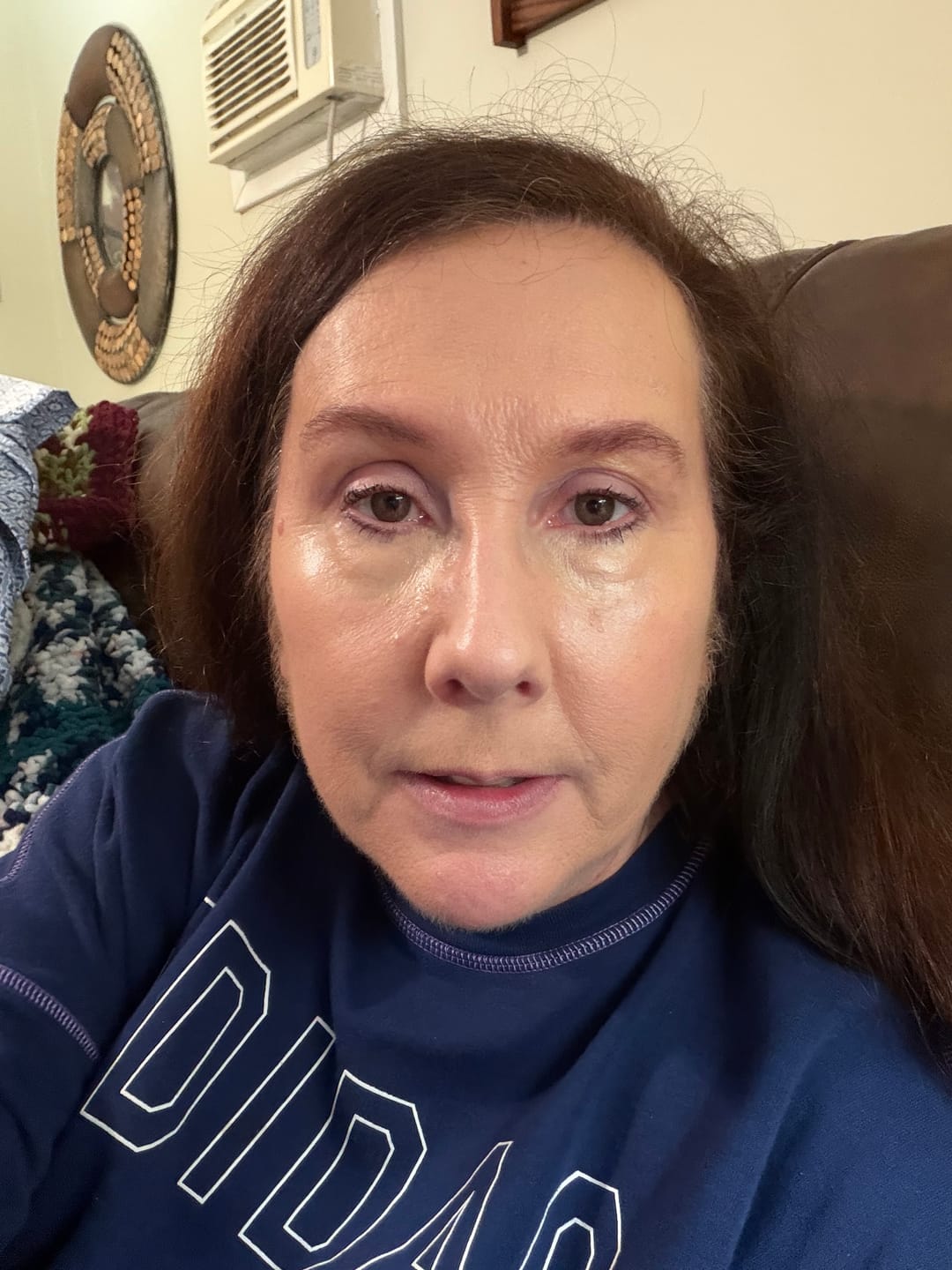Customer photo review of Eyeling Custom Lens – 1 Month