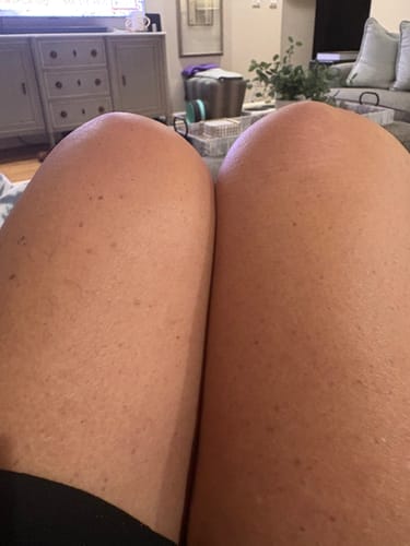 Customer photo review of Besque® Magic Body Oil XL - 200ml