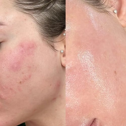 Customer photo review of Crema al collagene coreano | Pelle Pelle Pulita in 7 giorni