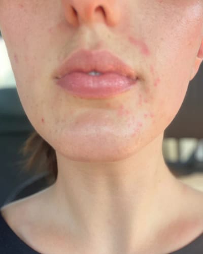 Customer photo review of Crema al collagene coreano | Pelle Pelle Pulita in 7 giorni