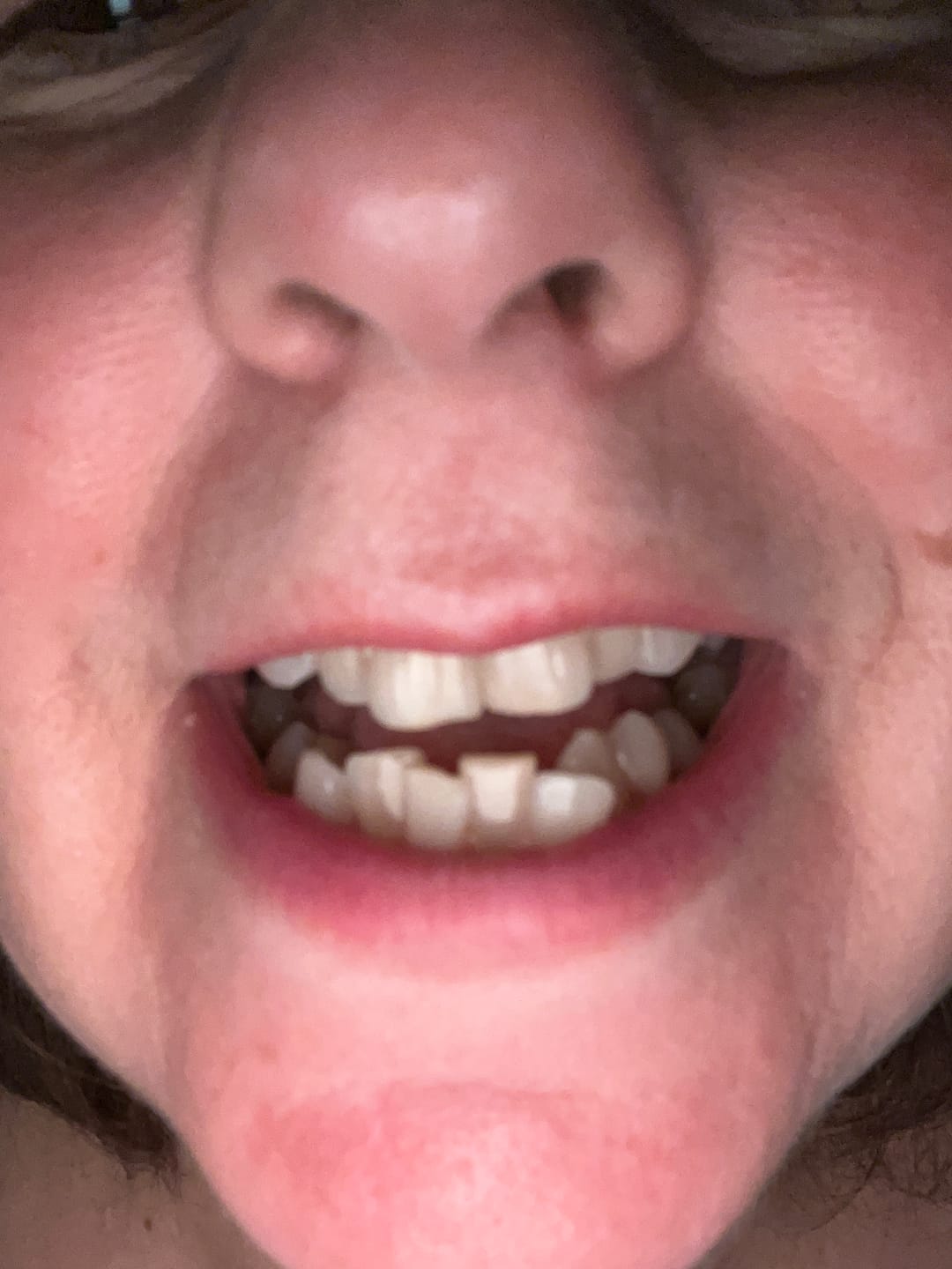 Customer photo review of Pack Gel Violet : 2 Gels Violets Kauka Smile