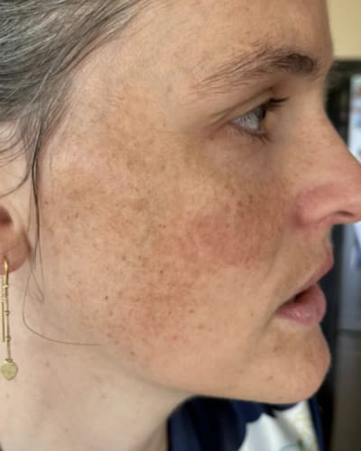 Customer photo review of Crema al collagene coreano | Pelle Pelle Pulita in 7 giorni