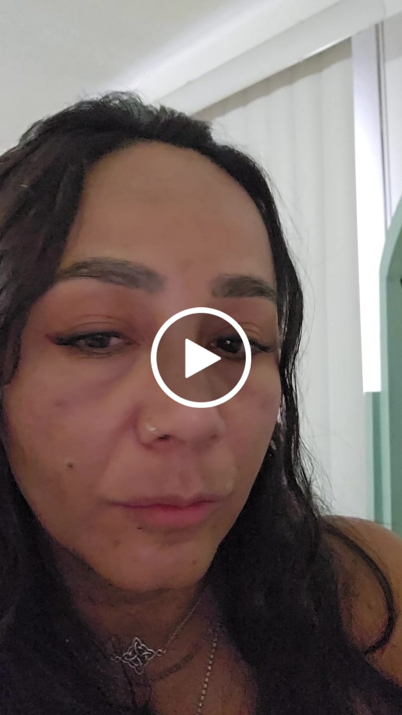 Customer video review of Aliva