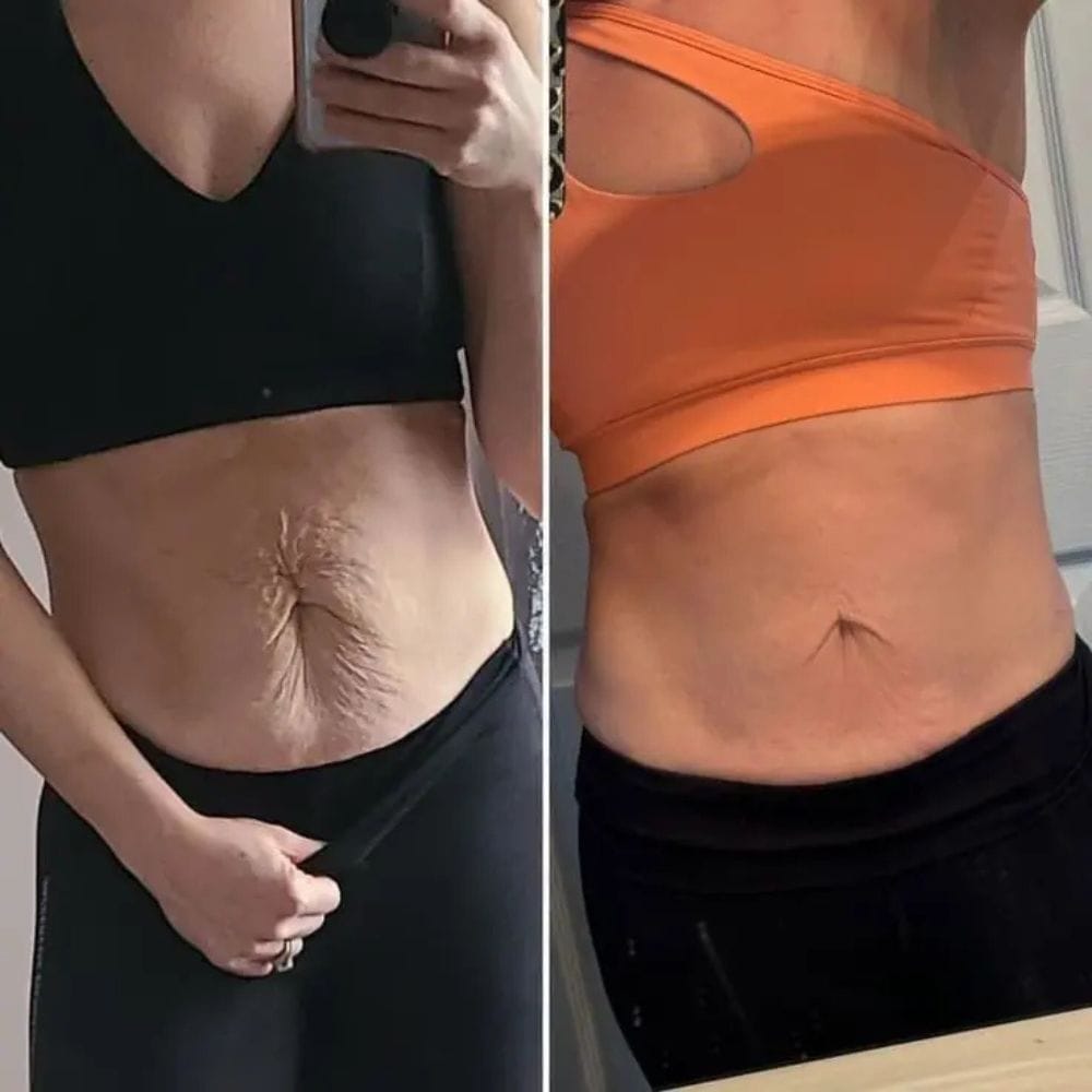 Customer photo review of Cellugone 3.0: Glättet Cellulite und strafft Bauch, Beine & Po für zuhause