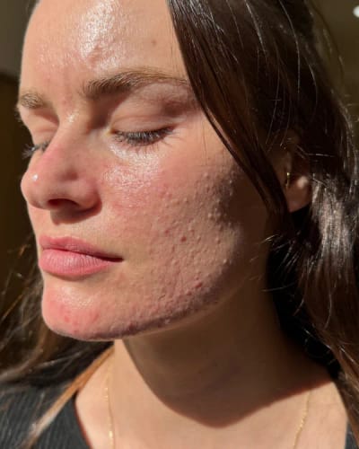 Customer photo review of Crema al collagene coreano | Pelle Pelle Pulita in 7 giorni