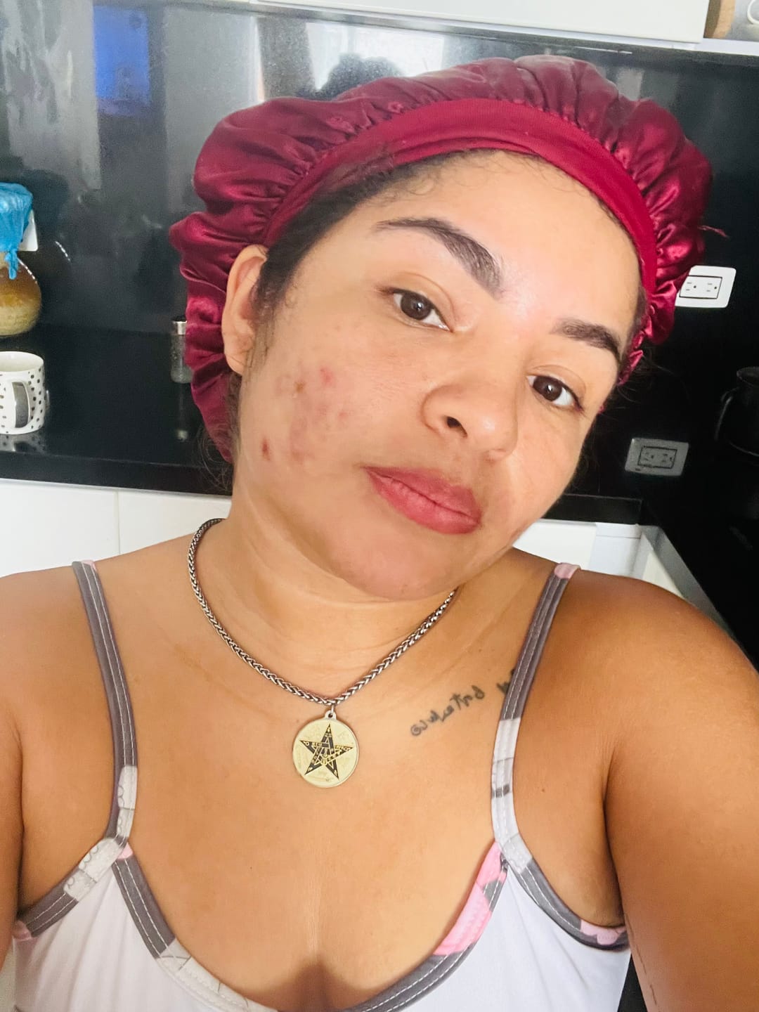 Customer photo review of Tónico Anti-Imperfecciones