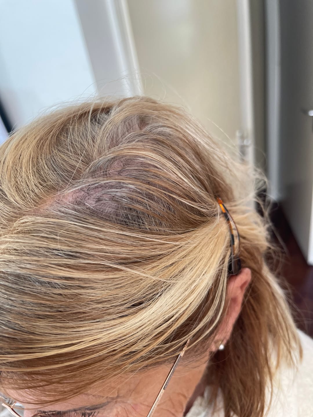 Customer photo review of HAIR RICH | BRENG JE HAAR WEER TOT LEVEN!