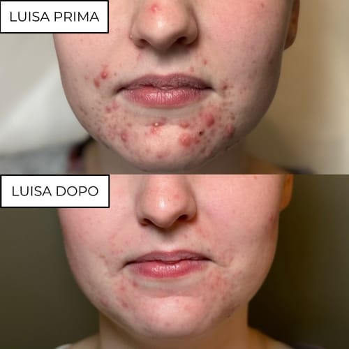 Customer photo review of Crema al collagene coreano | Pelle Pelle Pulita in 7 giorni