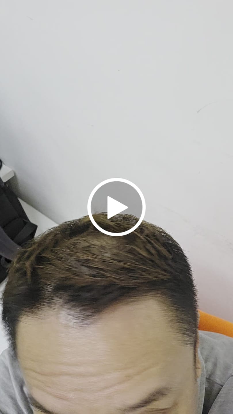 Customer video review of SMiB Anti Hair Loss Series - Discovery Kit 100ml Set - Women's Day 26
