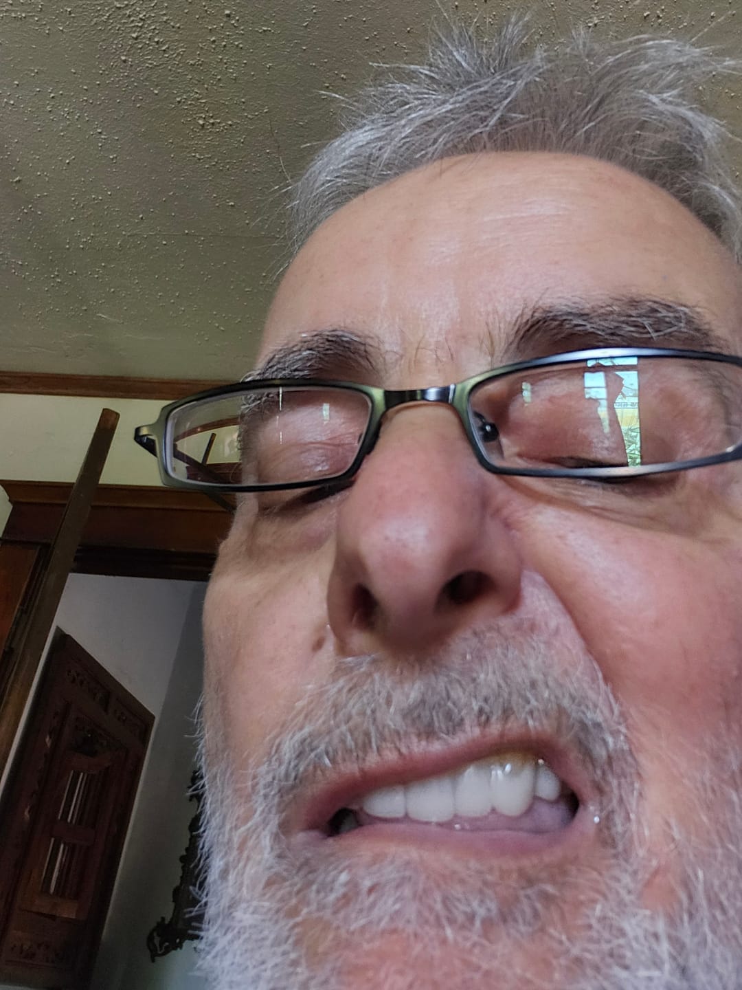 Customer photo review of Revived Veneers