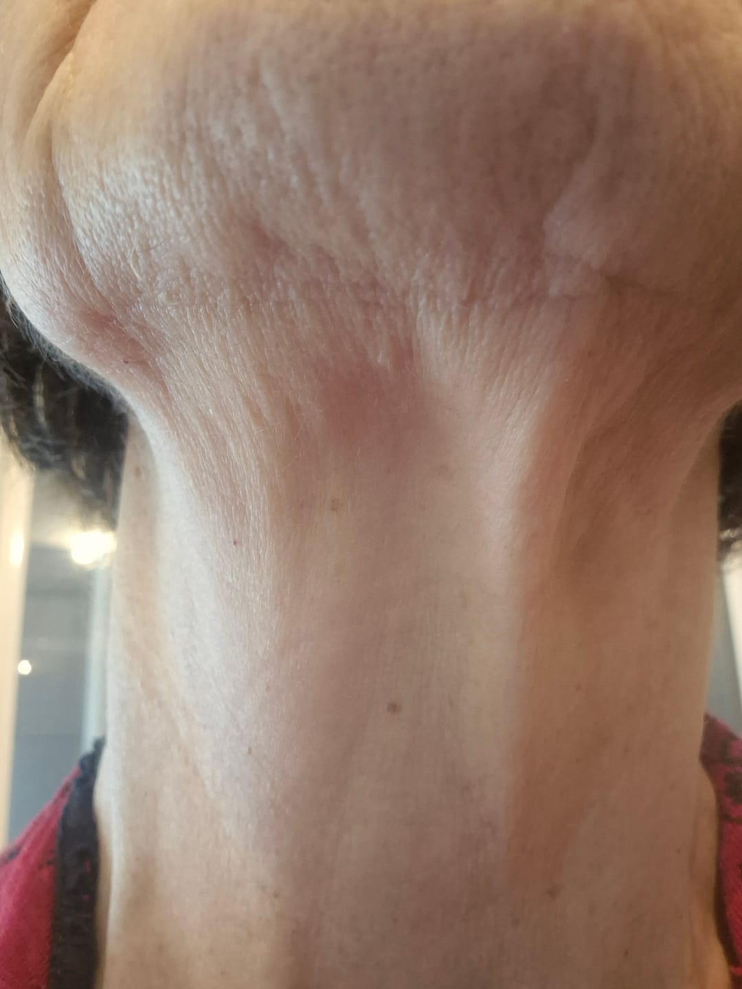 Customer photo review of Maschere Collo Aurealface™