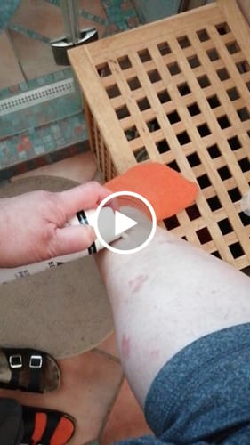 Customer video review of SERENI Pikkelysömör és Ekcéma Krém