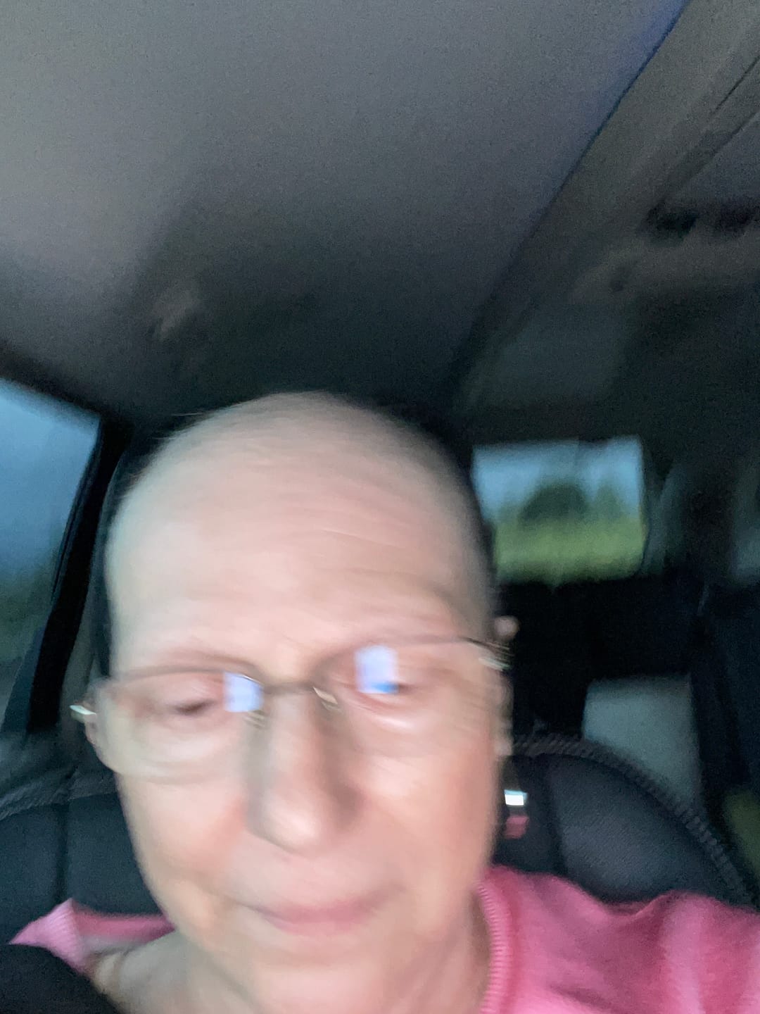 Customer photo review of Chemo Cream for Scalp