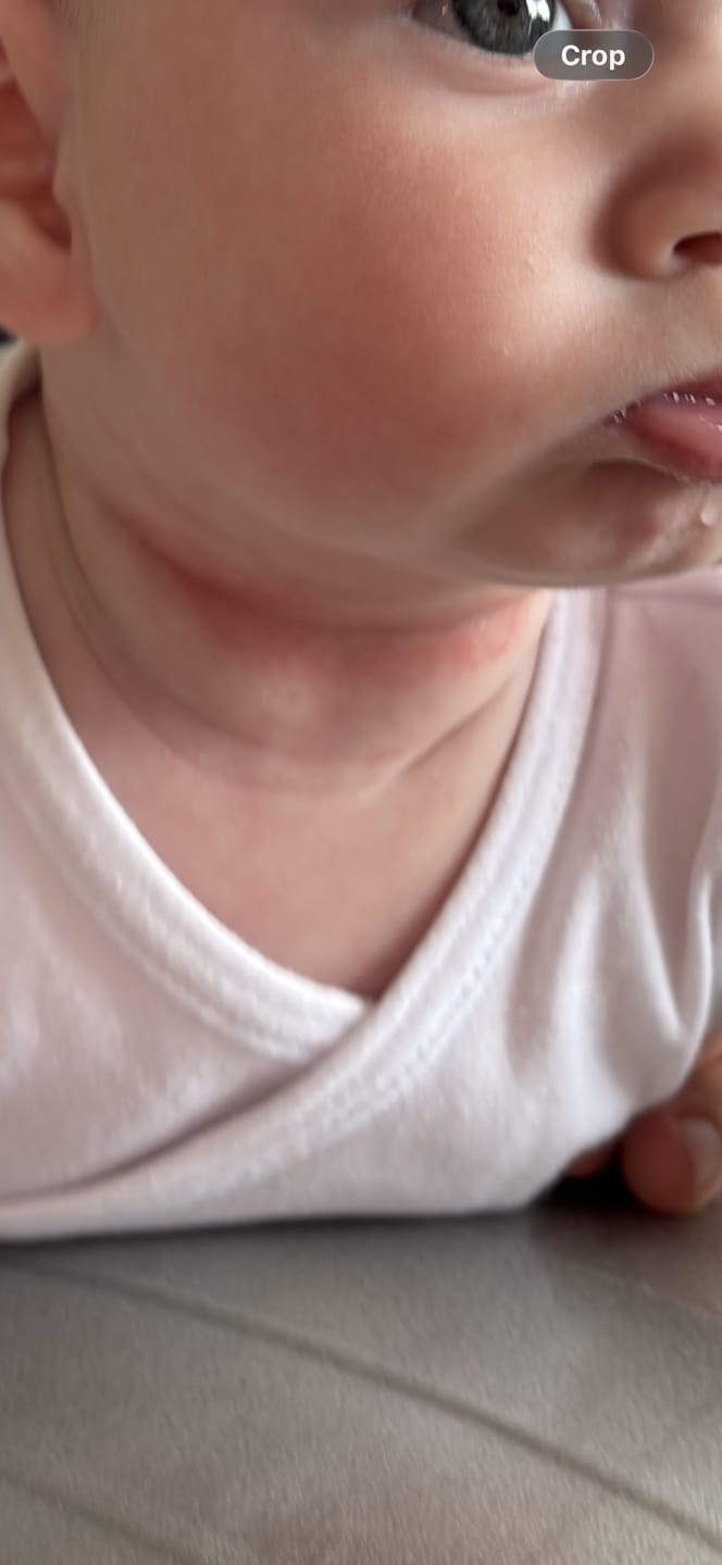 Customer photo review of קרם הרגעה והקלה בגירוי העור- פורטה- פתרון לגירויים, יובש או אדמומיות מכף רגל ועד ראש
