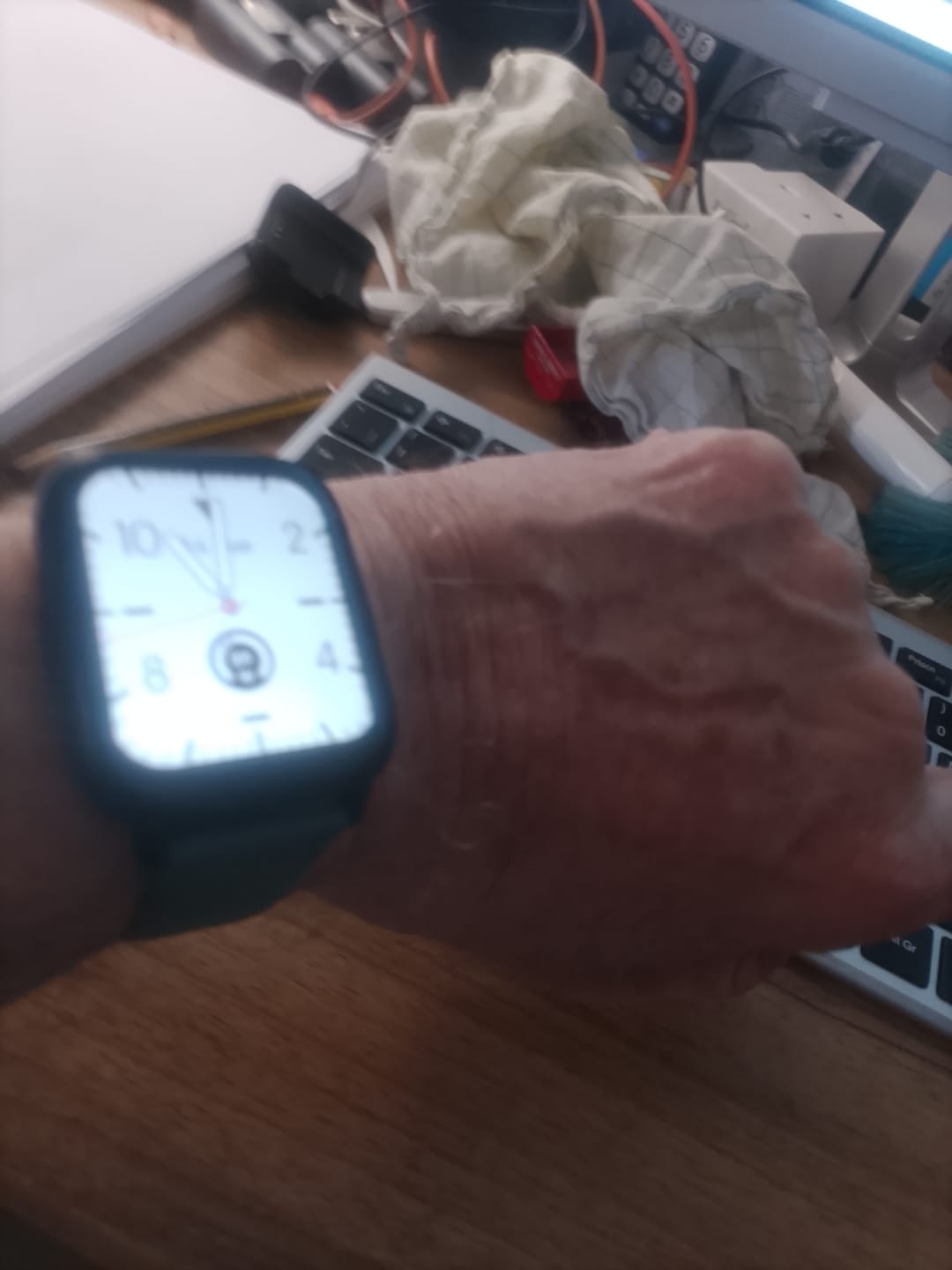 Customer photo review of Health Smartwatch 2 Screen Protector