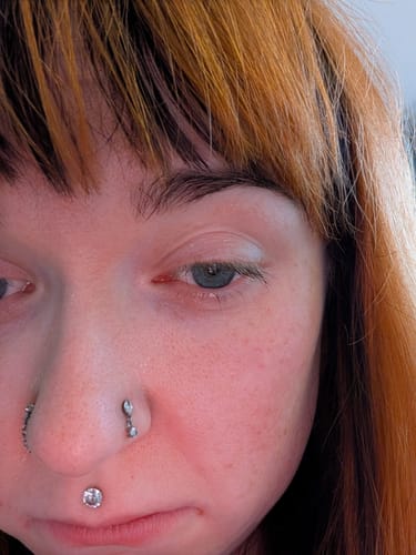 Customer photo review of Seb Natural Calming Serum