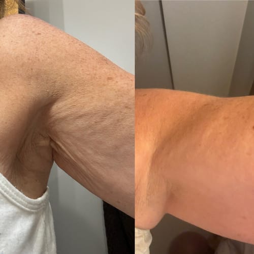 Customer photo review of Besque® Magic Body Oil - 100ml