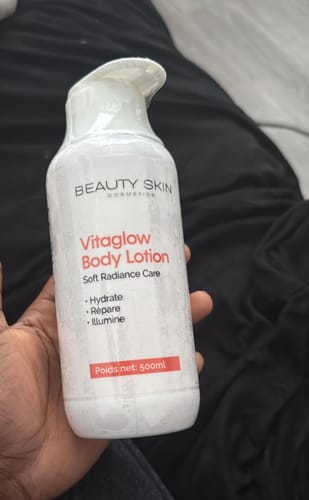 Customer photo review of VITAGLOW BODY LOTION- SOFT RADIANCE CARE