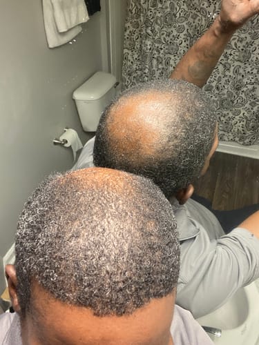 Customer result