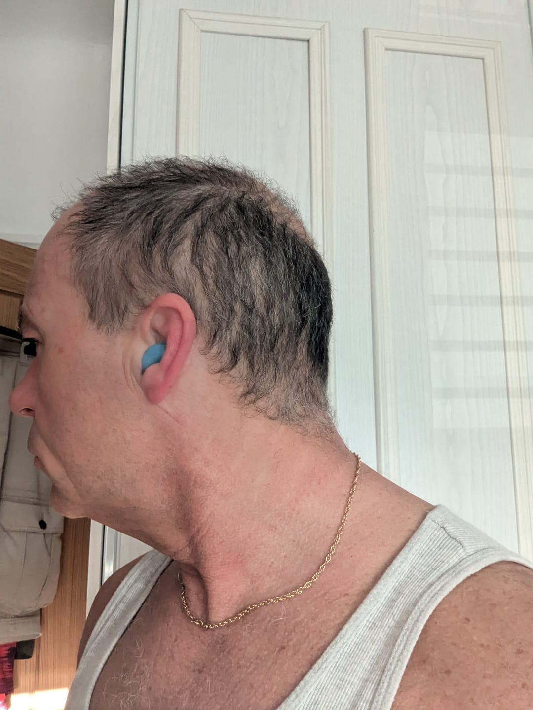 Customer photo review of HiStrips Earplugs