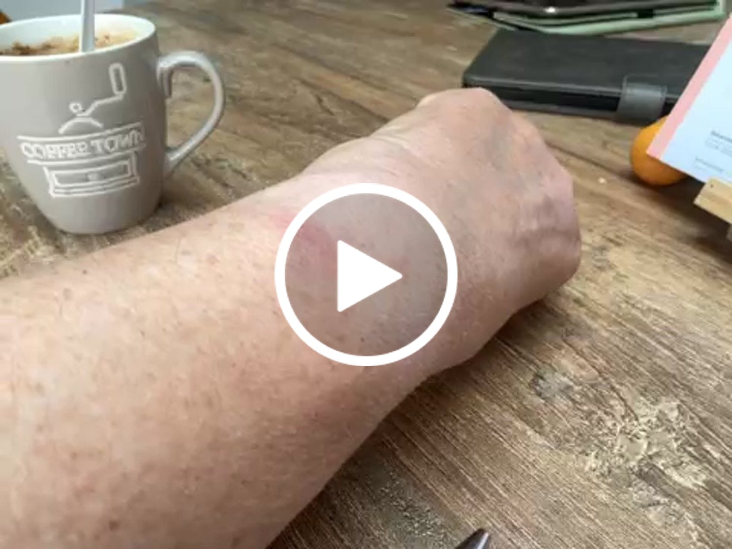 Customer video review of Siltcon® Auréa Smartwatch Dames Zwart