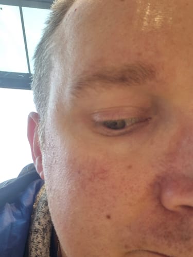 Customer photo review of Seb Natural Soothing Balm